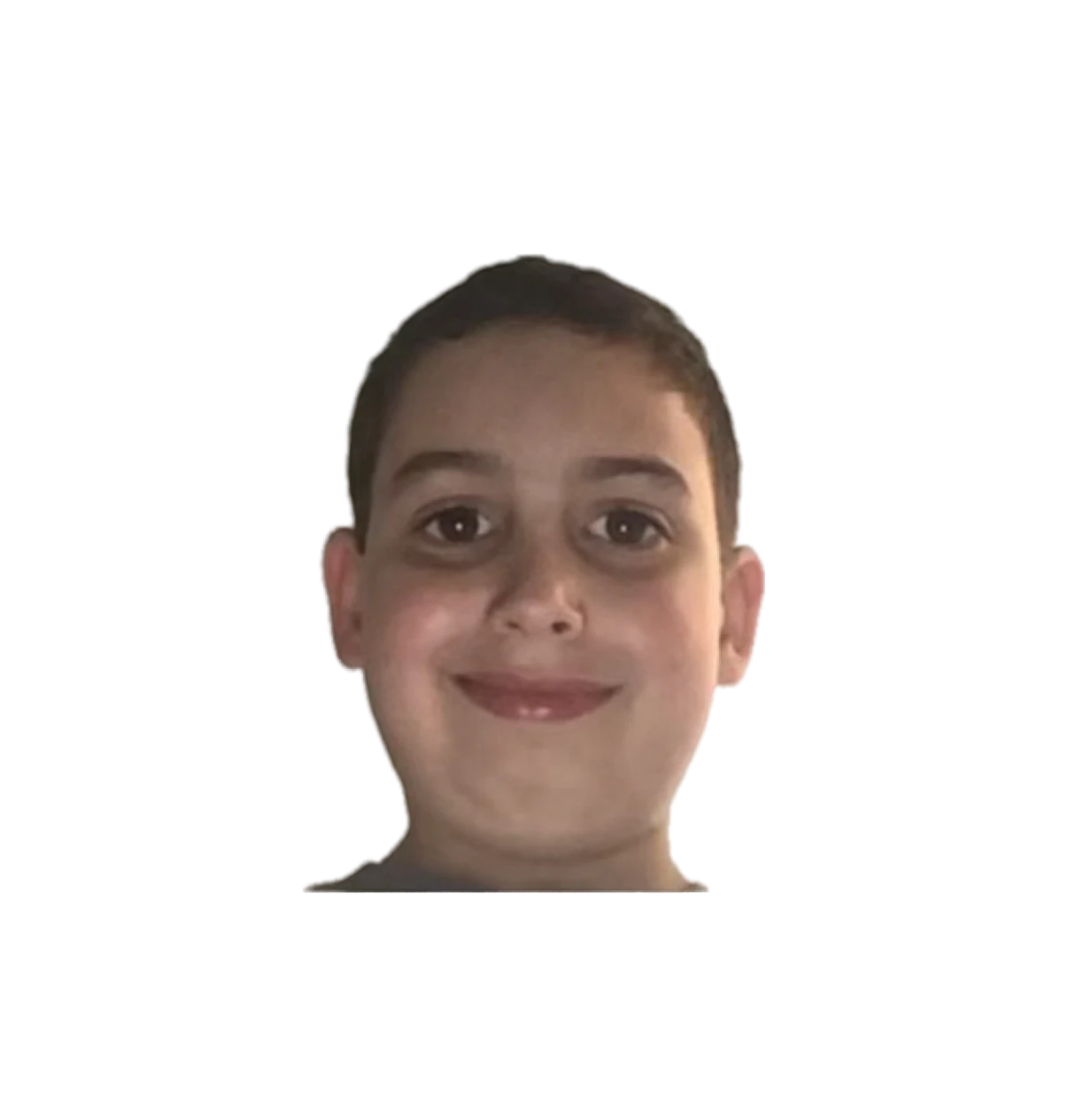 Bennettsbaldhead